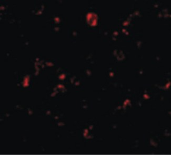 MTBP/Mdm2-Binding Protein Antibody