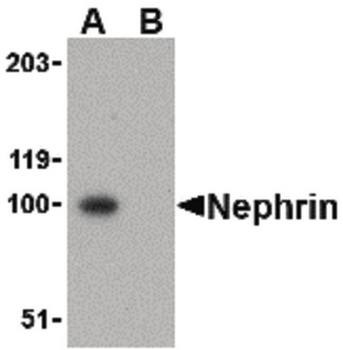 NPHS1/Nephrin Antibody