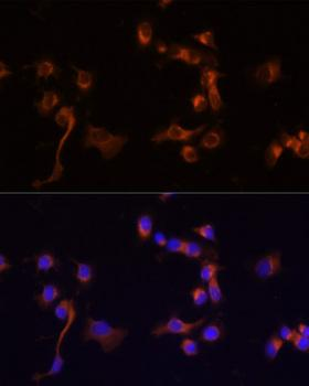 ABL1/c-ABL Antibody