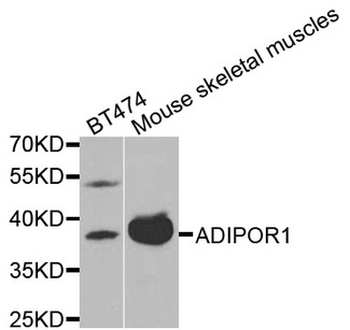 ADIPOR1/Adiponectin Receptor 1 Antibody