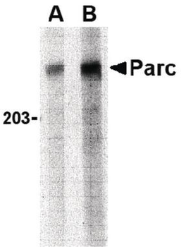 CUL9/Cullin 9 Antibody
