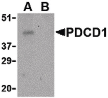 PDCD1/CD279/PD-1 Antibody