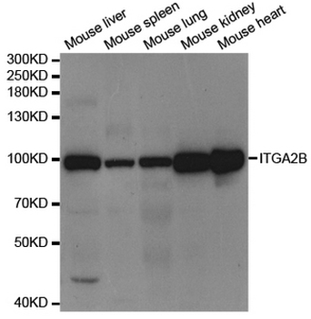 ITGA2B/CD41 Antibody