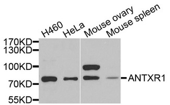 ANTXR1/TEM8 Antibody