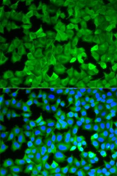 ASNS Antibody