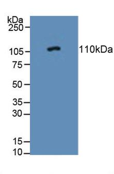 PTPRN/IA-2 Antibody