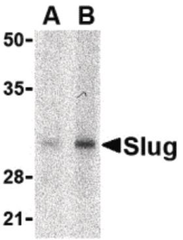 SNAI2/SLUG Antibody