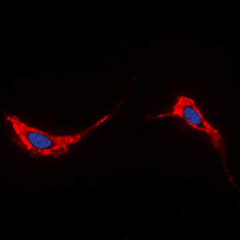 AQP2/Aquaporin 2 Antibody