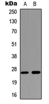 AQP2/Aquaporin 2 Antibody