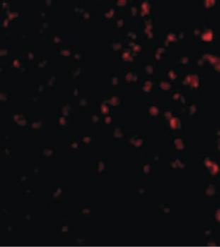 TIMD4/TIM4/TIM-4 Antibody
