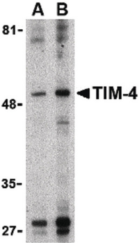 TIMD4/TIM4/TIM-4 Antibody