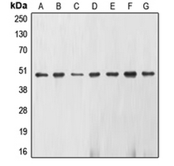 ENO2/NSE Antibody