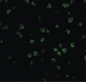 TNFRSF14/CD270/HVEM Antibody