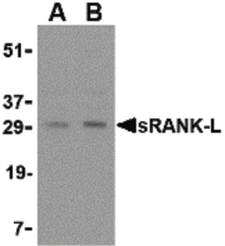 TNFSF11/RANKL/TRANCE Antibody