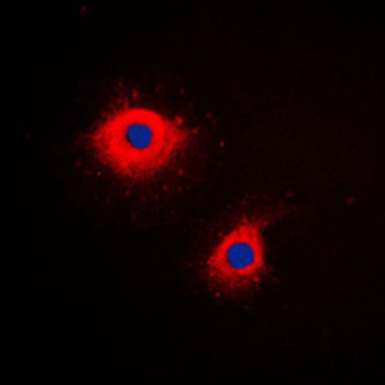 KRT7/CK7/Cytokeratin 7 Antibody