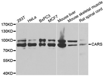 CARS1/CARS Antibody