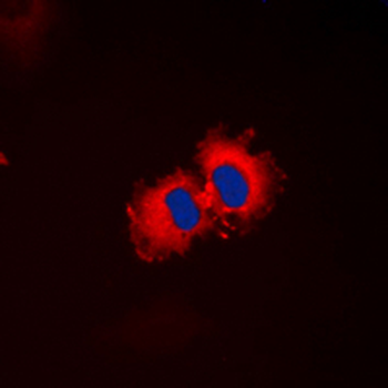 RALDH2/ALDH1A2 Antibody