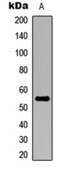 RALDH2/ALDH1A2 Antibody