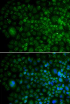 Angiogenin/ANG Antibody