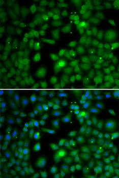 TFEB Antibody