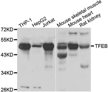 TFEB Antibody