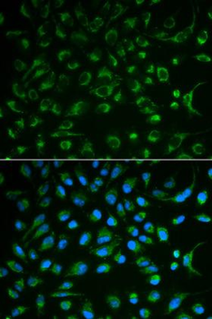 NT5E/eNT/CD73 Antibody