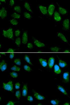 IL1RN Antibody