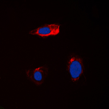 CST1/Cystatin SN Antibody