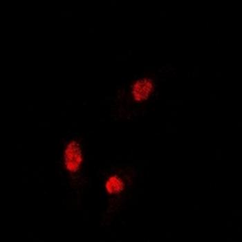SOX5 Antibody