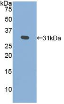 GLA/Alpha Galactosidase Antibody