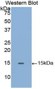 GLA/Alpha Galactosidase Antibody