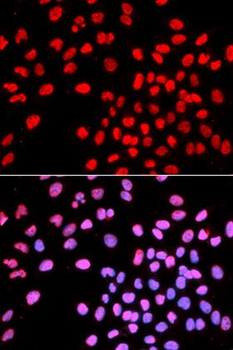 IKZF1/IKAROS Antibody