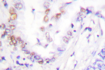 AML1/RUNX1 Antibody