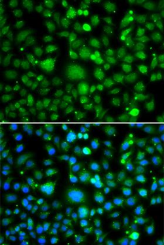 TEK/TIE2 Antibody