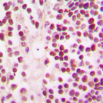 CREBBP/CREB Binding Protein Antibody