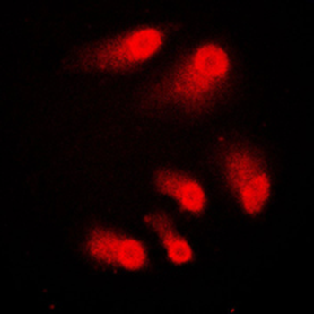 CREBBP/CREB Binding Protein Antibody
