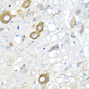 MGP/Matrix Gla-Protein Antibody