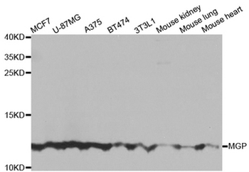 MGP/Matrix Gla-Protein Antibody