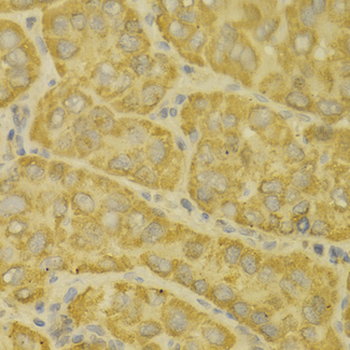 MAOA/Monoamine Oxidase Antibody
