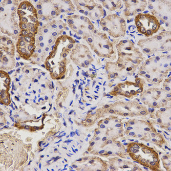 TAP2 Antibody