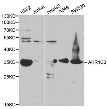 DDX/AKR1C3 Antibody