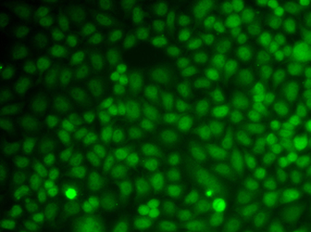 GADD45A/GADD45 Antibody