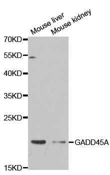GADD45A/GADD45 Antibody