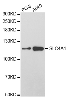 SLC4A4/NBC1 Antibody