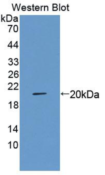 MARCO Antibody