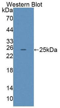 LRP2/Megalin Antibody