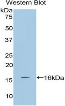 EPO/Erythropoietin Antibody