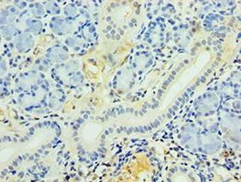 PDGF-D Antibody