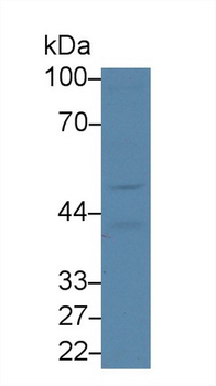 TPBG/5T4 Antibody