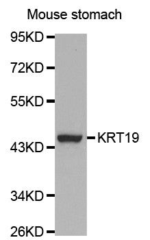 KRT19/CK19/Cytokeratin 19 Antibody
